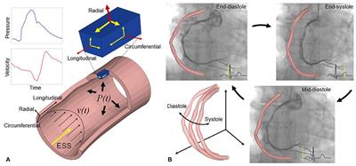 Angiography-Based 4-Dimensional Superficial Wall Strain and Stress: A New Diagnostic Tool in the Catheterization Laboratory